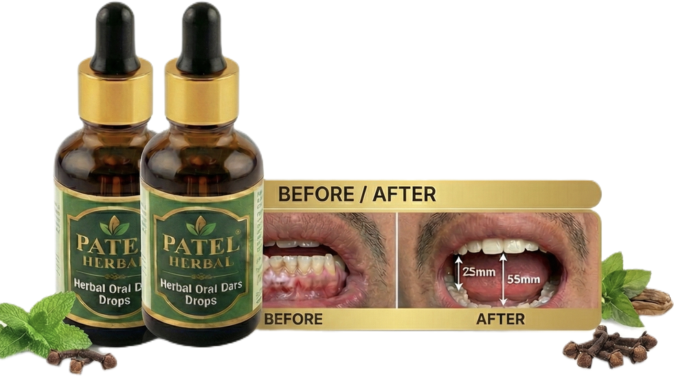 Patel Herbal Healing Drops – Fast Relief for Mouth Sores, White Patches, Gutka/Supari Damage, Gum Swelling & Dry Mouth
