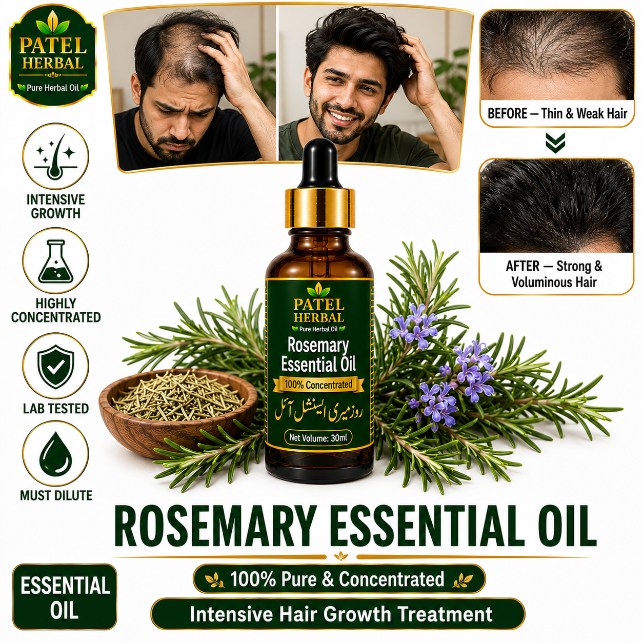 Rosemary Essential Oil – 100% Pure Concentrated Therapeutic-Grade Oil for Hair Growth & Aromatherapy | 30ml