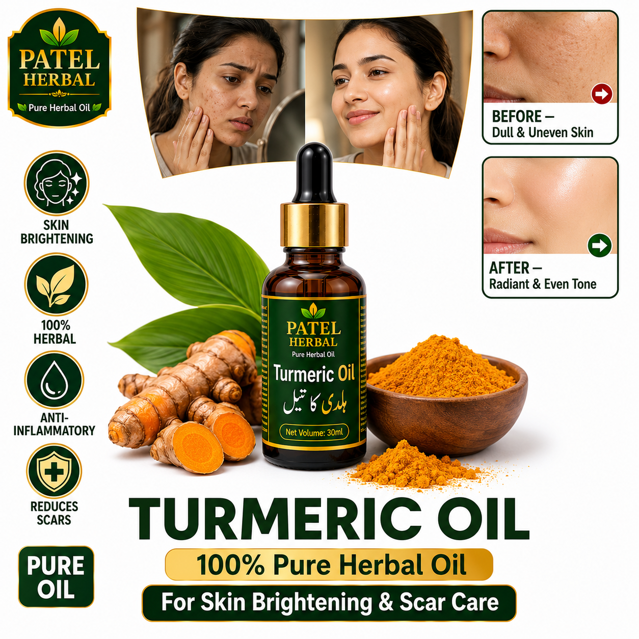 Turmeric Oil (Haldi) – 100% Pure Herbal Oil for Skin Brightening & Scar Care | 30ml
