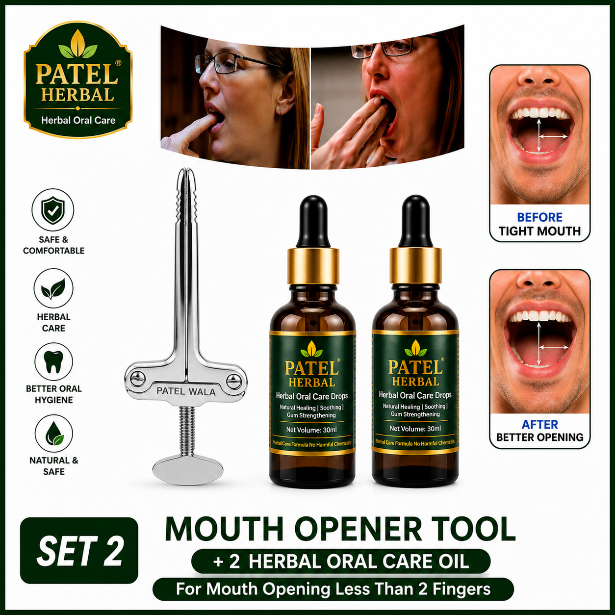 Premium Metal Mouth Opener Tool with 2 Herbal Oral Care Oils | Jaw Exercise Kit (Set 2)