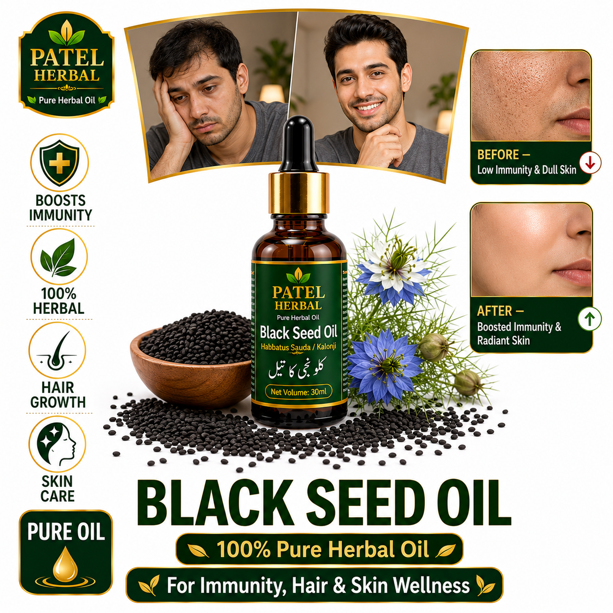 Black Seed Oil (Kalonji / Habbatus Sauda) – 100% Pure Herbal Oil for Immunity, Hair & Skin | 30ml