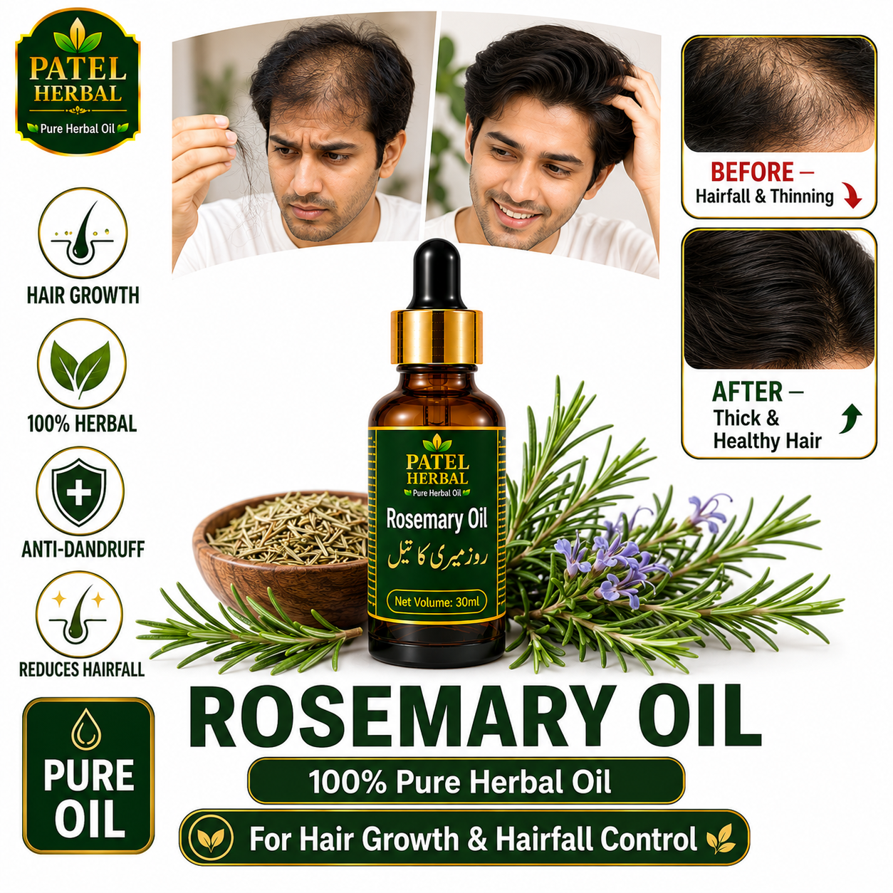 Rosemary Oil – 100% Pure Herbal Oil for Hair Growth & Hairfall Control | 30ml